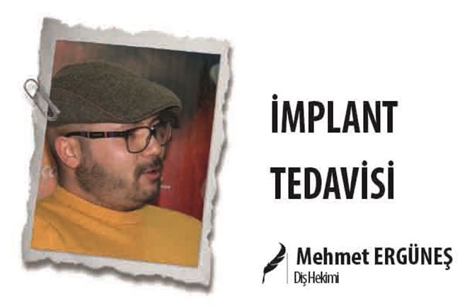 İMPLANT TEDAVİSİ