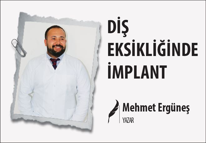 DİŞ EKSİKLİĞİNDE İMPLANT