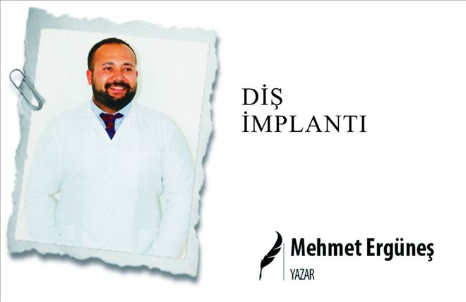 DİŞ İMPLANTI 