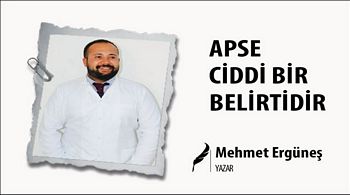 APSE CİDDİ BİR BELİRTİDİR